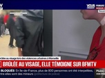 Replay Fauvelle Week-end - Brûlée au visage, elle témoigne sur BFMTV - 03/10