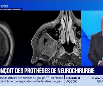 Replay Good Morning Business - Balt développe des dispositifs endovasculaires, fins comme des cheveux