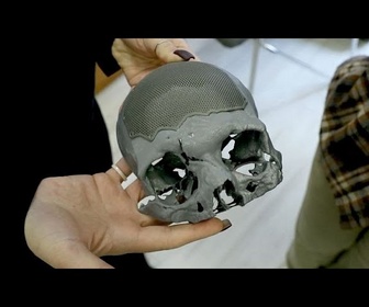 Replay En Ukraine, cette clinique redonne un visage aux anciens soldats défigurés
