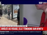 Replay BFM Grand Soir - Brûlée au visage, elle témoigne sur BFMTV - 03/10